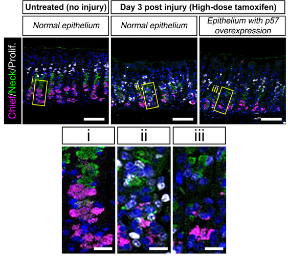Mäuse-Magenepithel ohne Verletzung (links) und am Tag 3 nach der Verletzung (dpi3) mit hochdosiertem Tamoxifen (HDT) (Mitte). Rechts: Epithel mit p57-Überexpression an dpi3 mit HDT. Das Epithel ist für Hauptzellen (magenta), Halszellen (grün) und proliferierende Zellen (weiß) gefärbt. Unten: Einschübe aus den drei Tafeln oben, die die Gruben der Magendrüsen zeigen. ©Lee/Koo/CellStemCell/IMBA.